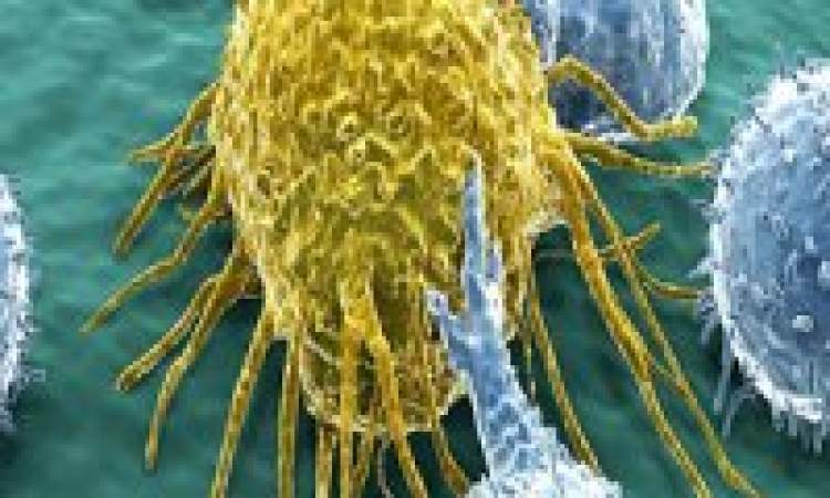نابودی سلول های سرطانی با تلفیق داروهای دو سرطان
