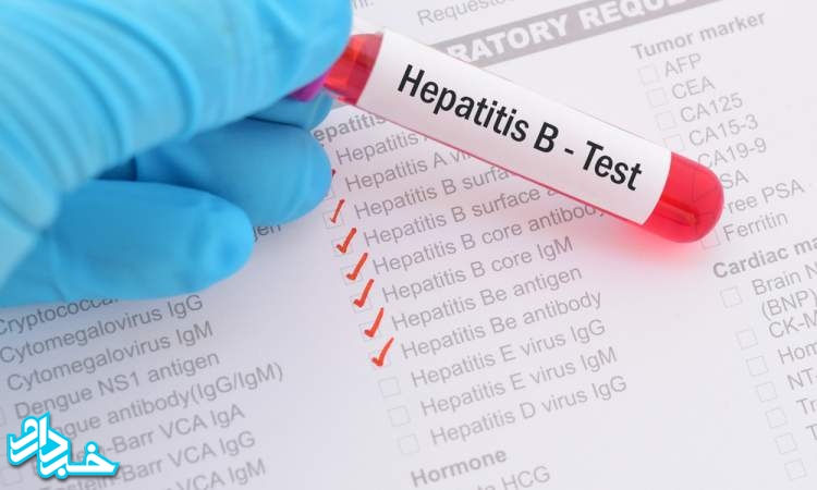 کاهش آمار مبتلایان به هپاتیت B در کشور